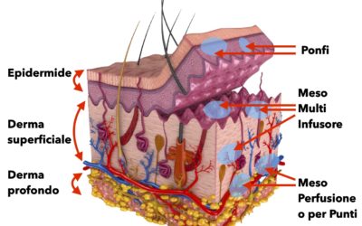 Mesoterapia – Intradermoterapia